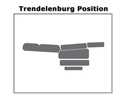 Trendelenburg Position